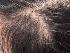 -上海市皮肤病医院(武夷路院区)