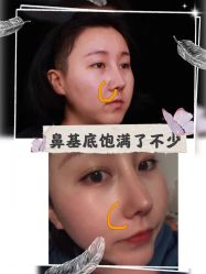 -美莱医学美容医院