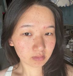 -Yestar艺星医疗美容医院