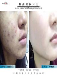 -黎蓓露·徒手骨雕蛋白抗衰·调肤管理