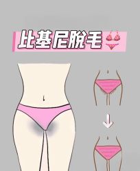 -薇兰专业脱毛连锁机构