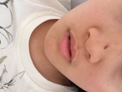 VIO维奥国际皮肤美容连锁机构-MedSkinCare科技祛痘肌肤修护中心