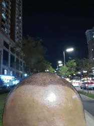 体验后-大麦微针植发全国连锁