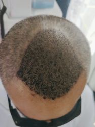 -雍禾植发全国连锁