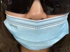-黑马眼科·近视手术