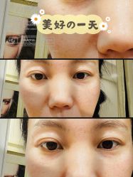 体验前-新美荟医美·专注面部美学抗衰