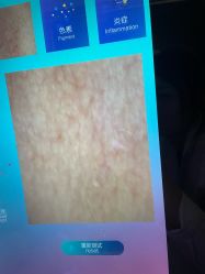 -skin79皮肤管理中心