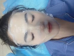 体验前-安徽合肥韩美整形外科医院