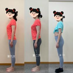 -卓拓普拉提
