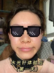体验后-JS医疗美容