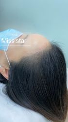 -MISS STAR·半永久纹眉·发际线·美瞳线