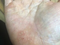 -深圳安仁堂中医·推拿按摩·肩颈调理