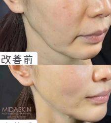 -MIDA蜜哒•科技逆龄美肤连锁