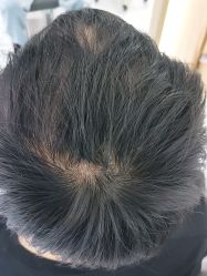 -发饰美男士增发补发假发定制店