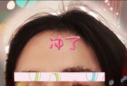 -大麦微针植发全国连锁