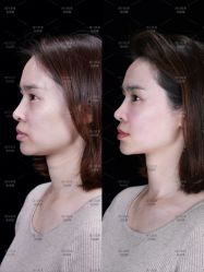 -美莱医学美容医院