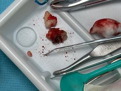 -北京大学口腔医院(第一门诊部)