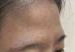 -天津健丽·去眼袋医疗美容机构