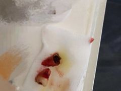 -和平卓尔口腔·矫正种植中心
