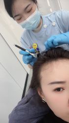 -大麦微针植发全国连锁