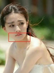 -贵阳美莱医疗美容整形医院