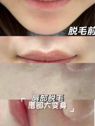 -智丽佳人祛斑祛痘美容美体