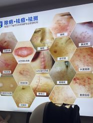 -资医堂·除疤祛痘祛斑