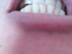 -微笑牙科口腔(三亚迎宾院区)