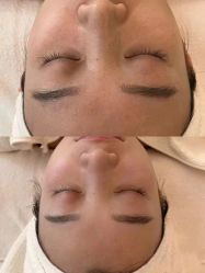 -安吉拉青春化管理中心