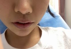 -小忠丽格医美