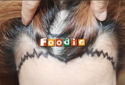 -大麦微针植发全国连锁