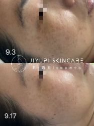 点击看大图 -MLP美丽派·问题肌疗愈中心