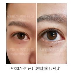-MLP美丽派·问题肌疗愈中心