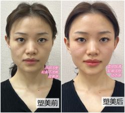 -美莱医学美容医院