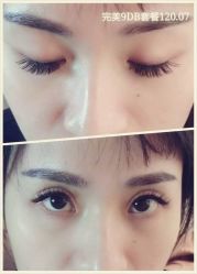 睫毛嫁接-光SPA科技美肤