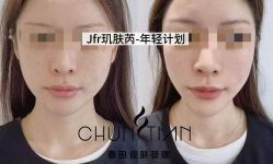 点击看大图 -春田皮肤管理中心品牌旗舰店