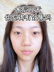 -天津健丽·去眼袋医疗美容机构