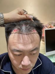 -熙朵美学植发·连锁品牌