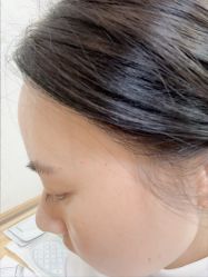 -长沙雅美医疗美容医院