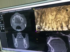 -同步齿科·数字化正畸种植口腔中心(珠海店)