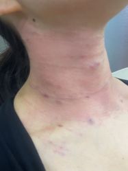 -武汉五洲整形外科医院