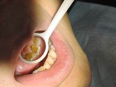 -土豆口腔(凤凰北总店)