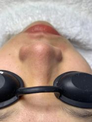 -痘院长·祛痘·科技美肤