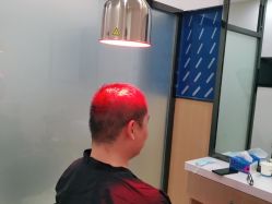 -雍禾植发全国连锁