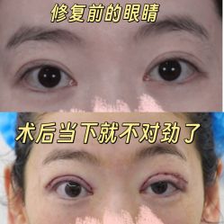 -丰联丽格医疗美容·联合丽格眼整形中心