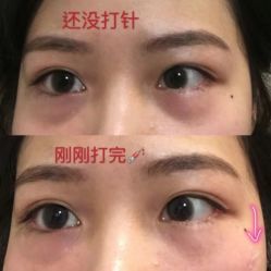 -上海伊莱美医疗美容医院