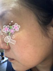 体验前-上海玫瑰医疗美容医院