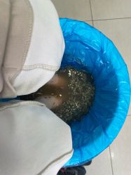 -德哥灰指甲脚气甲沟炎跖疣护理