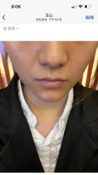 -铂特丽医美·眼鼻整形·光电美肤·注射抗衰