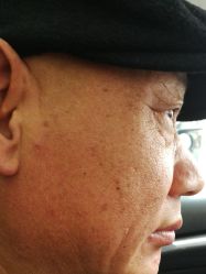 -痣清宫祛斑祛痣连锁店